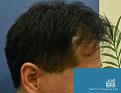 Click image for larger version

Name:	TCMD-LJHR9.jpg
Views:	461
Size:	73.2 KB
ID:	470774