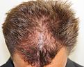 Click image for larger version

Name:	sm2 4 years post-op chin down.jpg
Views:	485
Size:	97.8 KB
ID:	470850