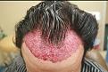 Click image for larger version

Name:	AMImmedPOD.jpg
Views:	600
Size:	83.5 KB
ID:	470876