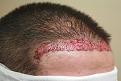 Click image for larger version

Name:	IRImmedPOA.jpg
Views:	631
Size:	76.0 KB
ID:	470886