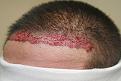 Click image for larger version

Name:	IRImmedPOB.jpg
Views:	656
Size:	77.7 KB
ID:	470887