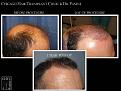 Click image for larger version

Name:	Slide2.JPG
Views:	331
Size:	72.4 KB
ID:	470894