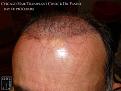 Click image for larger version

Name:	Slide7.JPG
Views:	330
Size:	72.1 KB
ID:	470899