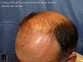 Click image for larger version

Name:	Slide10.JPG
Views:	322
Size:	74.7 KB
ID:	470902
