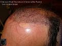 Click image for larger version

Name:	Slide11.JPG
Views:	327
Size:	80.4 KB
ID:	470903