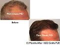 Click image for larger version

Name:	Hair Transplant Slides.540.jpg
Views:	421
Size:	36.0 KB
ID:	471041