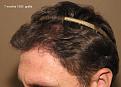 Click image for larger version

Name:	Album,   (20090325163912390) 20120112204121031.jpg
Views:	576
Size:	93.1 KB
ID:	471066