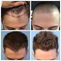 Click image for larger version

Name:	6monthcCollage.jpg
Views:	2234
Size:	82.9 KB
ID:	471303