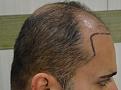 Click image for larger version

Name:	Pre_op_4.jpg
Views:	528
Size:	94.5 KB
ID:	471329