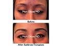 Click image for larger version

Name:	Hair Transplant Slides.564.jpg
Views:	418
Size:	60.3 KB
ID:	471333