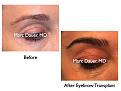 Click image for larger version

Name:	Hair Transplant Slides.593.jpg
Views:	645
Size:	60.4 KB
ID:	471441