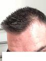 Click image for larger version

Name:	hairline5.jpg
Views:	13928
Size:	85.2 KB
ID:	471591