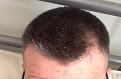 Click image for larger version

Name:	hairline3.jpg
Views:	27619
Size:	36.6 KB
ID:	471592