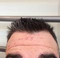 Click image for larger version

Name:	hairline1.jpg
Views:	3109
Size:	55.5 KB
ID:	471593