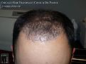 Click image for larger version

Name:	Slide8.JPG
Views:	333
Size:	70.8 KB
ID:	471788