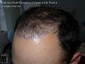 Click image for larger version

Name:	Slide9.JPG
Views:	336
Size:	70.6 KB
ID:	471789