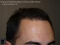 Click image for larger version

Name:	Slide16.JPG
Views:	339
Size:	54.1 KB
ID:	471796