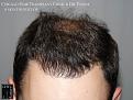 Click image for larger version

Name:	Slide18.JPG
Views:	339
Size:	74.9 KB
ID:	471798