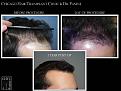 Click image for larger version

Name:	Slide2.JPG
Views:	239
Size:	73.3 KB
ID:	473405