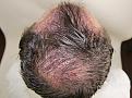 Click image for larger version

Name:	bm immediate post-op chin up 1.jpg
Views:	532
Size:	97.4 KB
ID:	473486