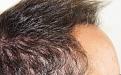 Click image for larger version

Name:	bm 6 months post-op R profile.jpg
Views:	478
Size:	99.6 KB
ID:	473491