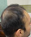 Click image for larger version

Name:	DSC_1033.jpg
Views:	422
Size:	85.6 KB
ID:	473537