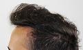 Click image for larger version

Name:	jf 4 yr fu L profile.jpg
Views:	390
Size:	90.9 KB
ID:	473783