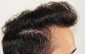 Click image for larger version

Name:	jf 4 yr fu R profile (2).jpg
Views:	405
Size:	97.2 KB
ID:	473784