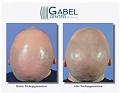 Click image for larger version

Name:	gabel.jpg
Views:	453
Size:	12.2 KB
ID:	473879