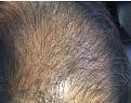 Click image for larger version

Name:	frontal third.jpg
Views:	582
Size:	92.3 KB
ID:	474115