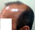 Click image for larger version

Name:	1_1439574423_left copy.jpg
Views:	495
Size:	46.1 KB
ID:	474153