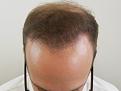 Click image for larger version

Name:	sd 9 months post chin down.jpg
Views:	471
Size:	75.6 KB
ID:	474164