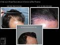 Click image for larger version

Name:	Slide2.JPG
Views:	304
Size:	72.3 KB
ID:	474175
