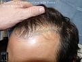 Click image for larger version

Name:	Slide7.JPG
Views:	293
Size:	85.5 KB
ID:	474182