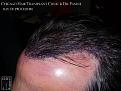 Click image for larger version

Name:	Slide11.JPG
Views:	311
Size:	80.5 KB
ID:	474188
