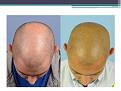 Click image for larger version

Name:	Slide2.JPG
Views:	516
Size:	54.0 KB
ID:	474242