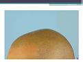 Click image for larger version

Name:	Slide6.JPG
Views:	509
Size:	38.2 KB
ID:	474246