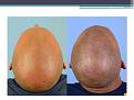 Click image for larger version

Name:	Slide3.JPG
Views:	389
Size:	50.0 KB
ID:	474258