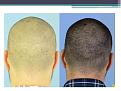 Click image for larger version

Name:	Slide2.JPG
Views:	1108
Size:	68.3 KB
ID:	474272