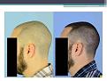 Click image for larger version

Name:	Slide4.JPG
Views:	1387
Size:	54.8 KB
ID:	474274