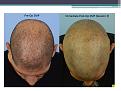 Click image for larger version

Name:	Slide2.JPG
Views:	662
Size:	61.7 KB
ID:	474277