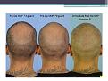 Click image for larger version

Name:	Slide4.JPG
Views:	604
Size:	63.2 KB
ID:	474279