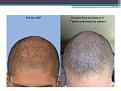 Click image for larger version

Name:	Slide5.JPG
Views:	635
Size:	62.4 KB
ID:	474280