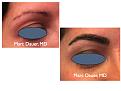 Click image for larger version

Name:	Hair Transplant Slides.744.jpg
Views:	348
Size:	58.6 KB
ID:	474298