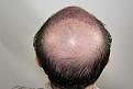 Click image for larger version

Name:	sd imm post-op chin up.jpg
Views:	309
Size:	89.0 KB
ID:	474521