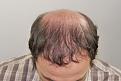 Click image for larger version

Name:	sd 10 mos post-op chin down.jpg
Views:	366
Size:	90.8 KB
ID:	474523