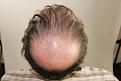Click image for larger version

Name:	sd 10 mos post-op chin up.jpg
Views:	361
Size:	90.4 KB
ID:	474524