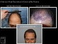 Click image for larger version

Name:	Slide1.JPG
Views:	338
Size:	69.1 KB
ID:	474620