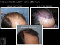 Click image for larger version

Name:	Slide2.JPG
Views:	371
Size:	73.2 KB
ID:	474621