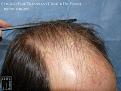 Click image for larger version

Name:	Slide10.JPG
Views:	350
Size:	88.0 KB
ID:	474629